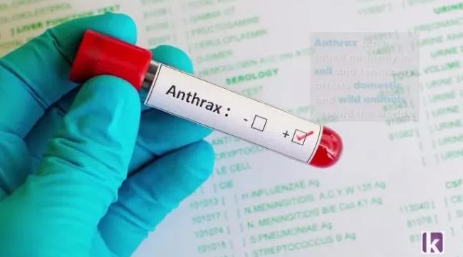 FG Warns Of High Morbidity, Mortality As Anthrax Outbreak Hits Zamfara