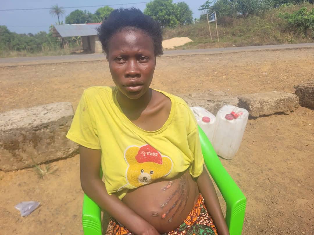 Pregnant woman wakes up with handprint on her belly after ‘spirit’ attack her in a dream