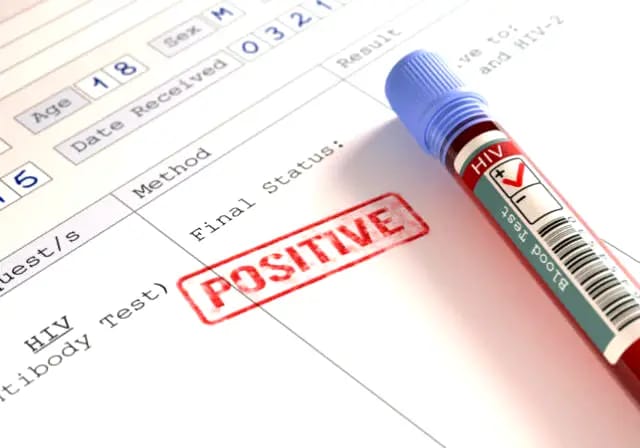 HIV Infections May Skyrocket If U.S. Cuts Funding, UNAIDS Sounds Alarm